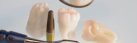 Clínica Dental Doctor Celestino García Alfaro dientes